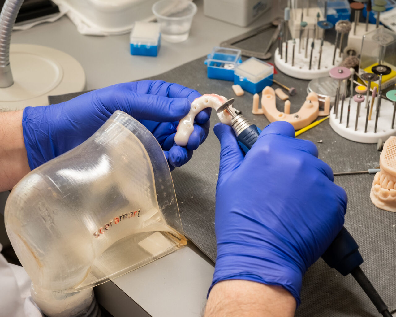'http://A%20person%20wearing%20blue%20gloves%20uses%20a%20dental%20tool%20to%20work%20on%20a%20dental%20prosthetic%20in%20a%20lab.%20Various%20dental%20models%20and%20instruments%20are%20visible%20on%20the%20workspace.