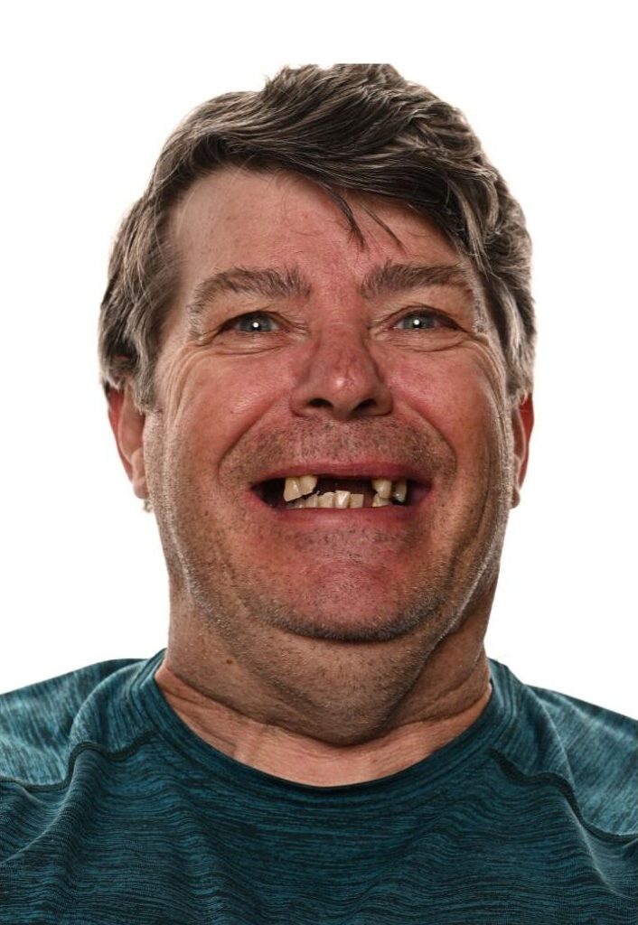 'http://A%20middle-aged%20man%20with%20messy%20brown%20hair%20and%20missing%20front%20teeth%20smiles%20widely,%20wearing%20a%20teal%20shirt%20against%20a%20white%20background.