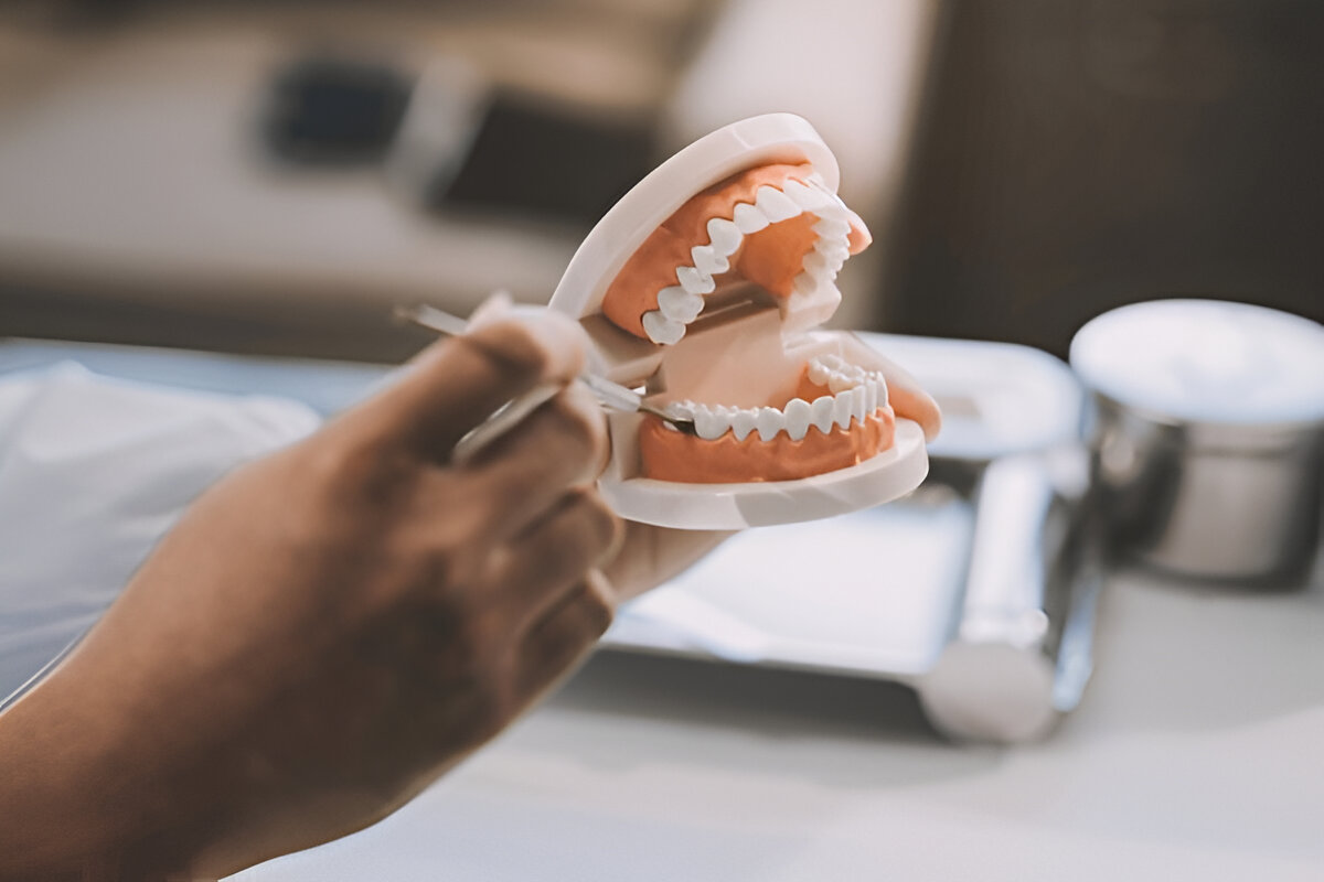 Implant-Supported Dentures Near You